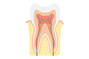 Root Canal Therapy | Vista Dental Care