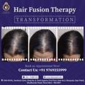 Hair transplant clinic in thane at Dna Royal